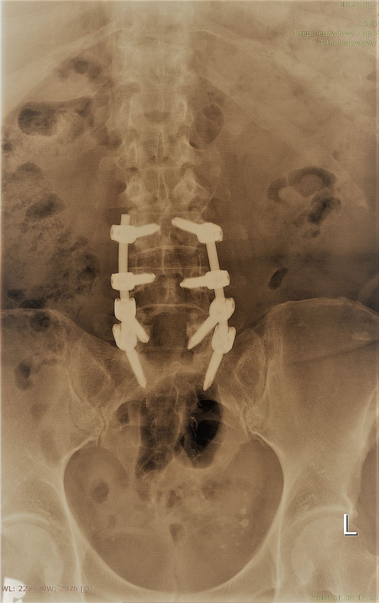 Jarosław Andrychowski-45