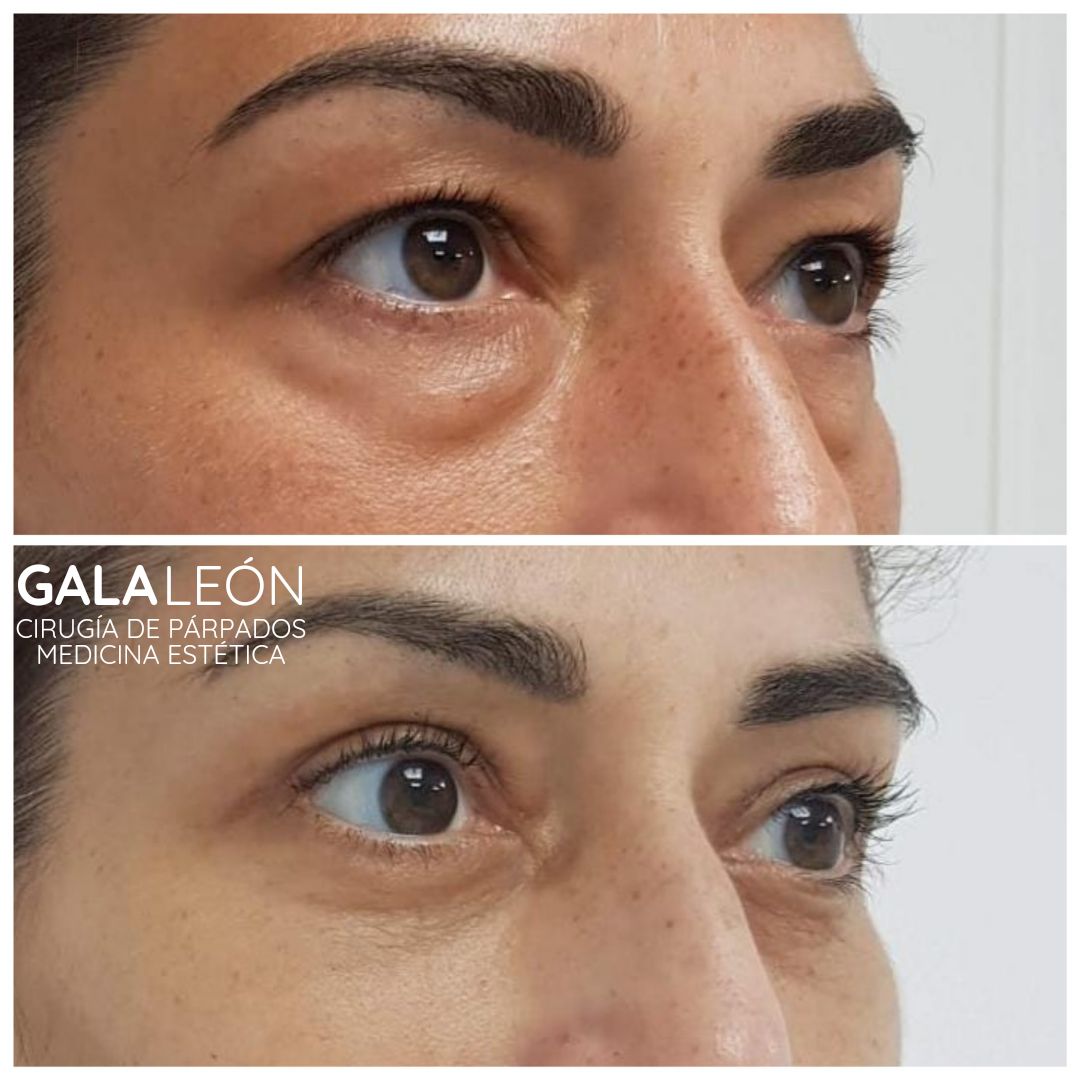 Gala P. Leon Salvatierra-32