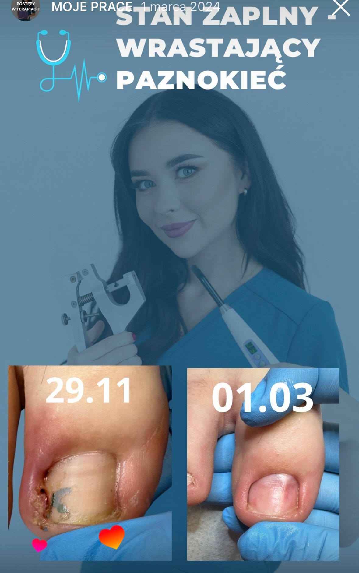 Karolina Colonna-Walewska-18