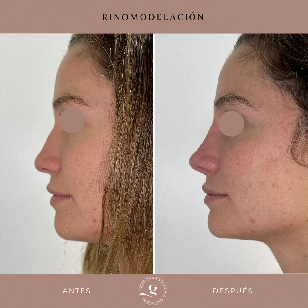 ​Giovanni Giorgianni-23