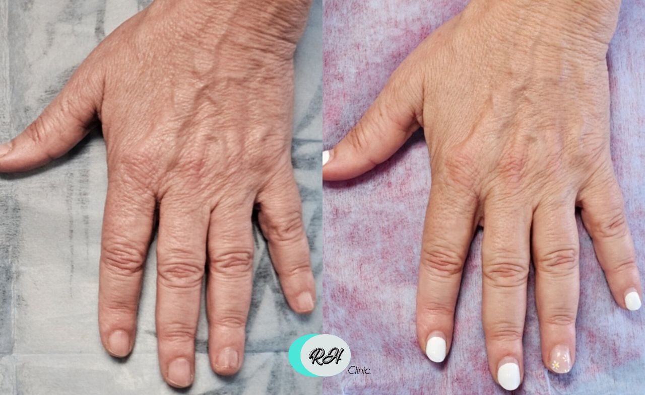 Rosalba Herrero Zerpa-617