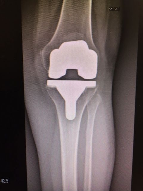 Massimo Brandolin-14