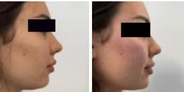 Silvia Melania Baio-21