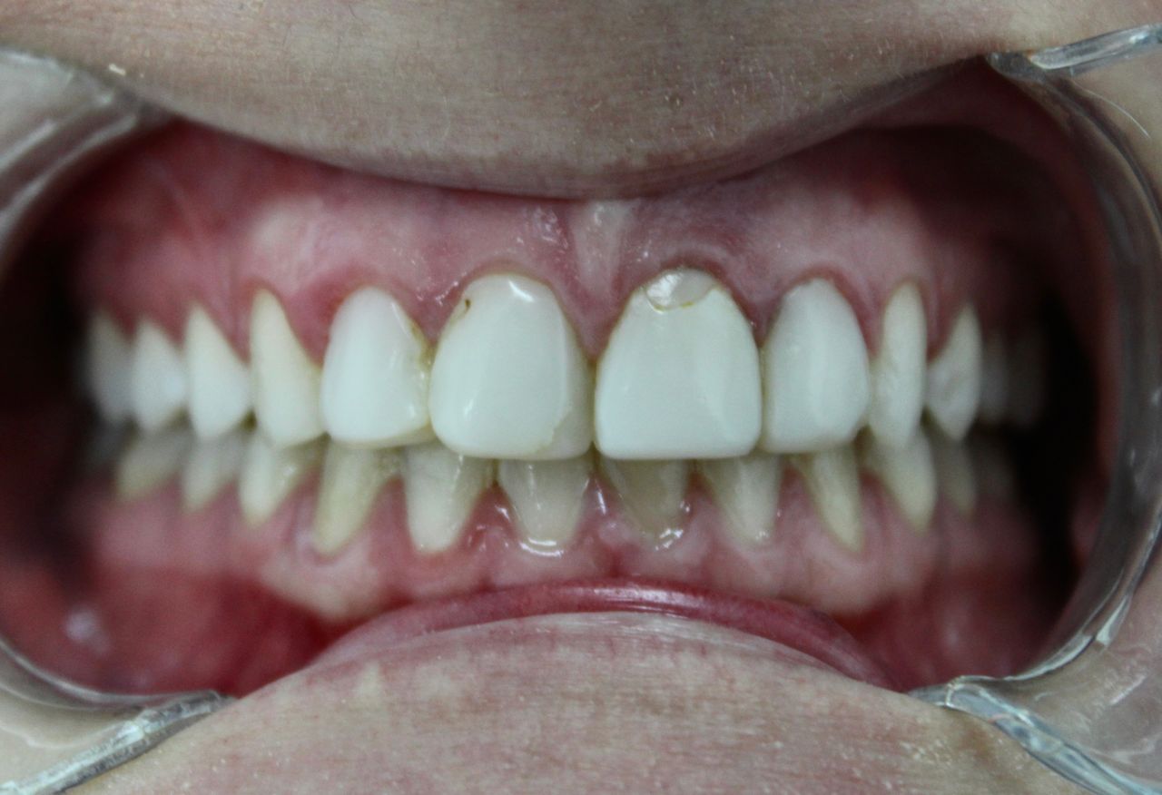 César Buján Riveiro-4