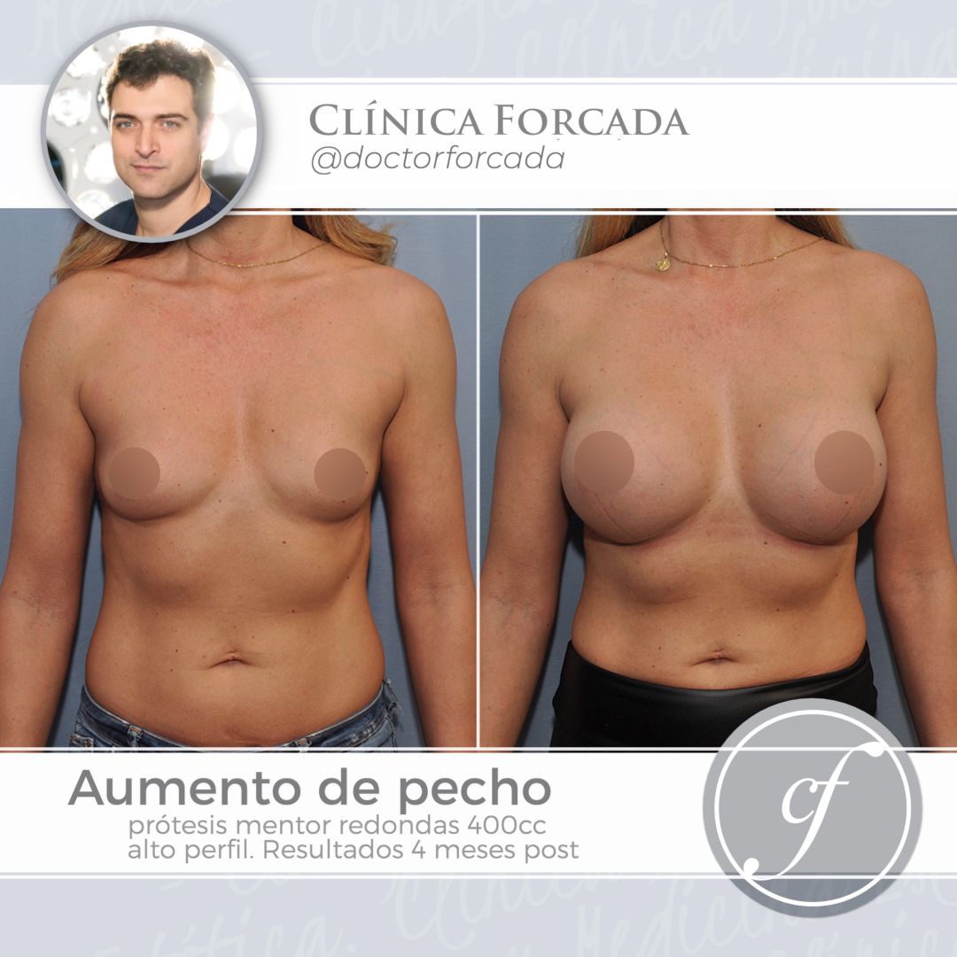 Eduardo Forcada Melero-8