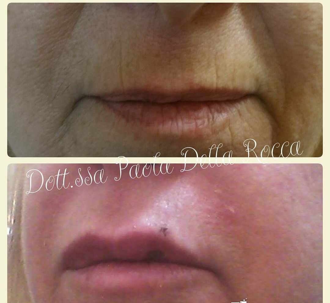 Paola Della Rocca-36