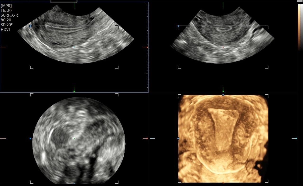 Valentina Del Negro-10