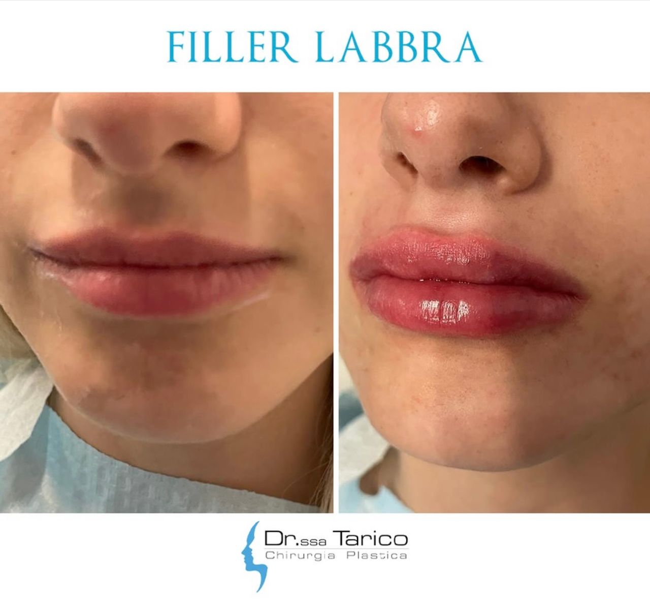 Maria Stella Tarico-10