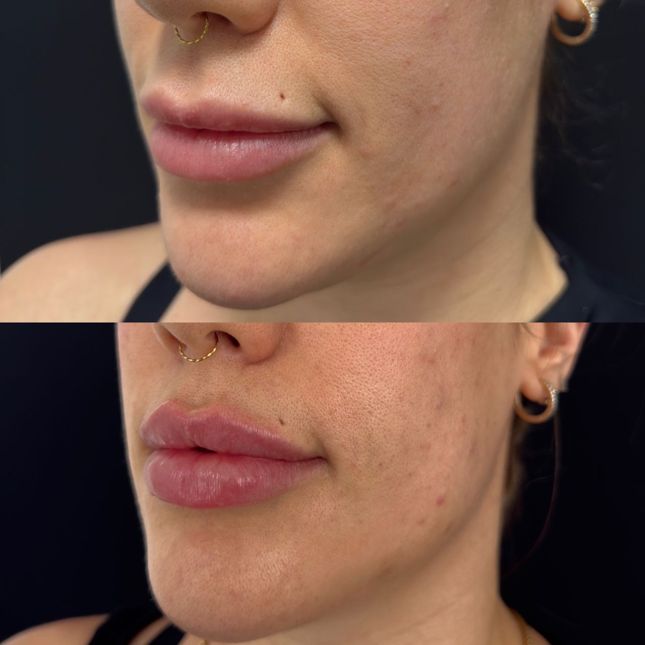 Raffaele Del Prete-4