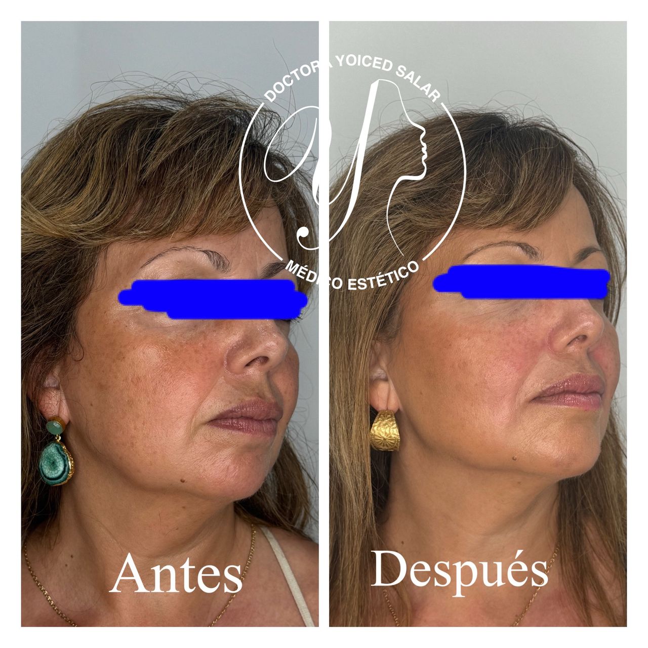 Yoiced Salar Peñate-31