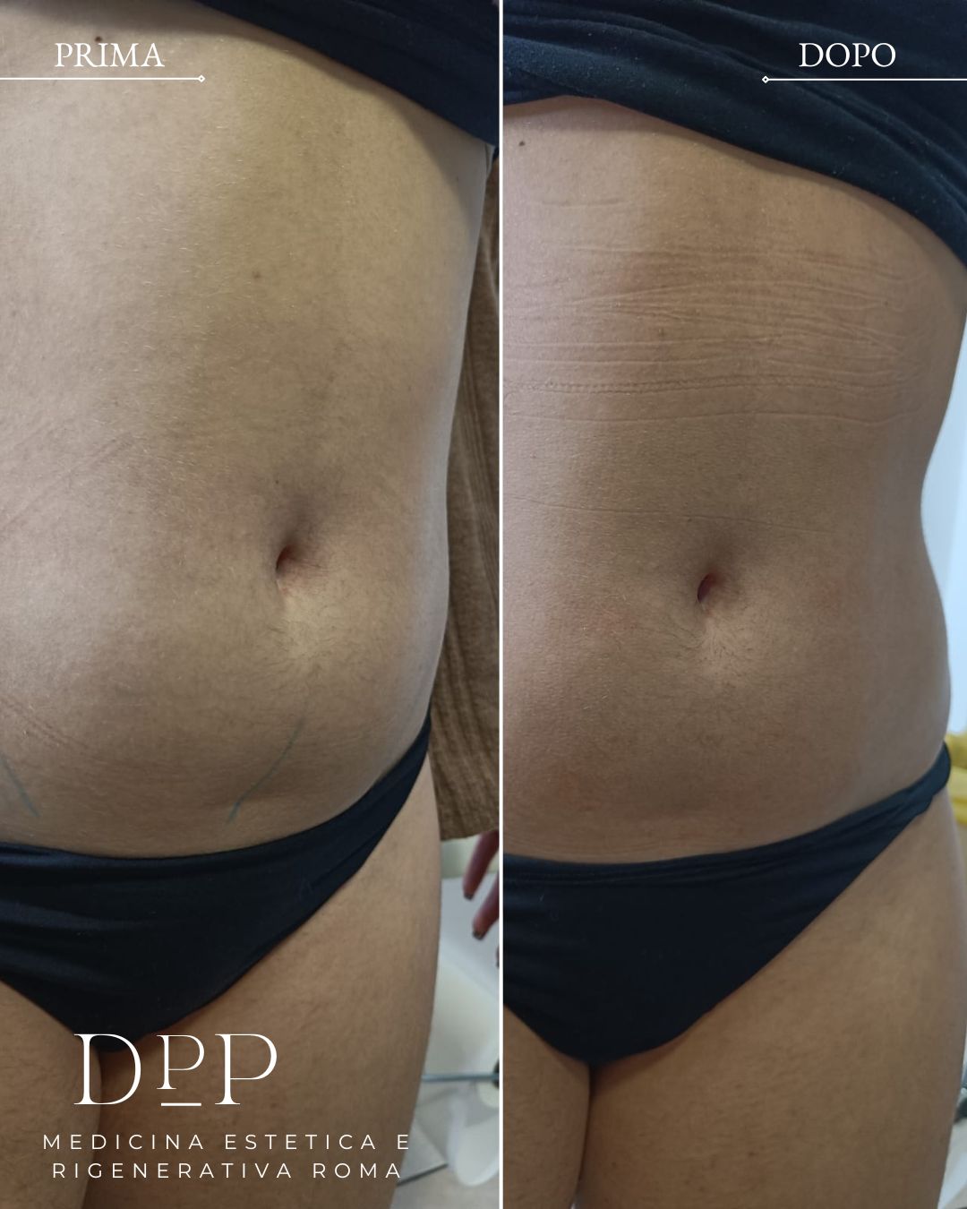 Davide Prosperi Porta-7