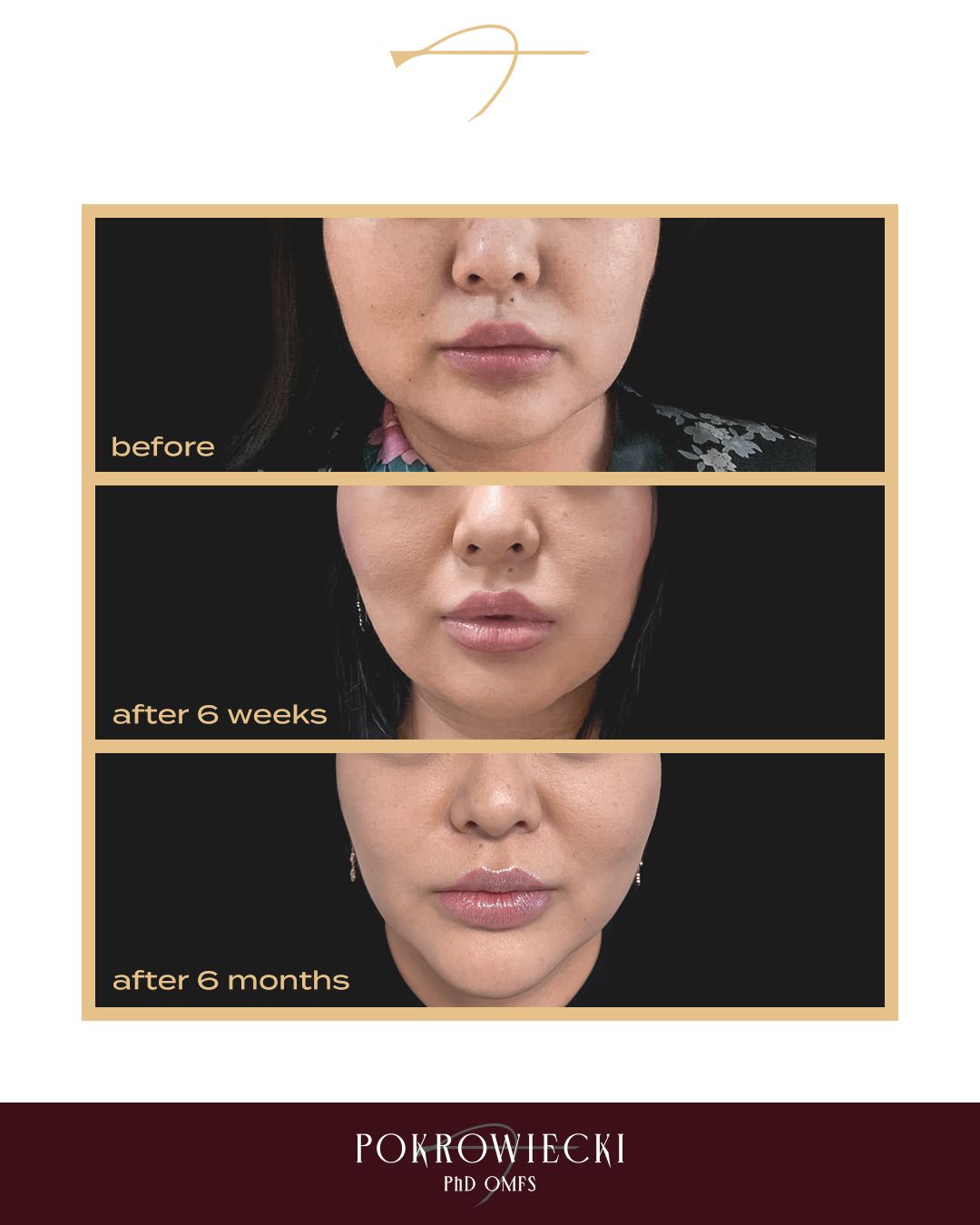 Rafał Pokrowiecki-14