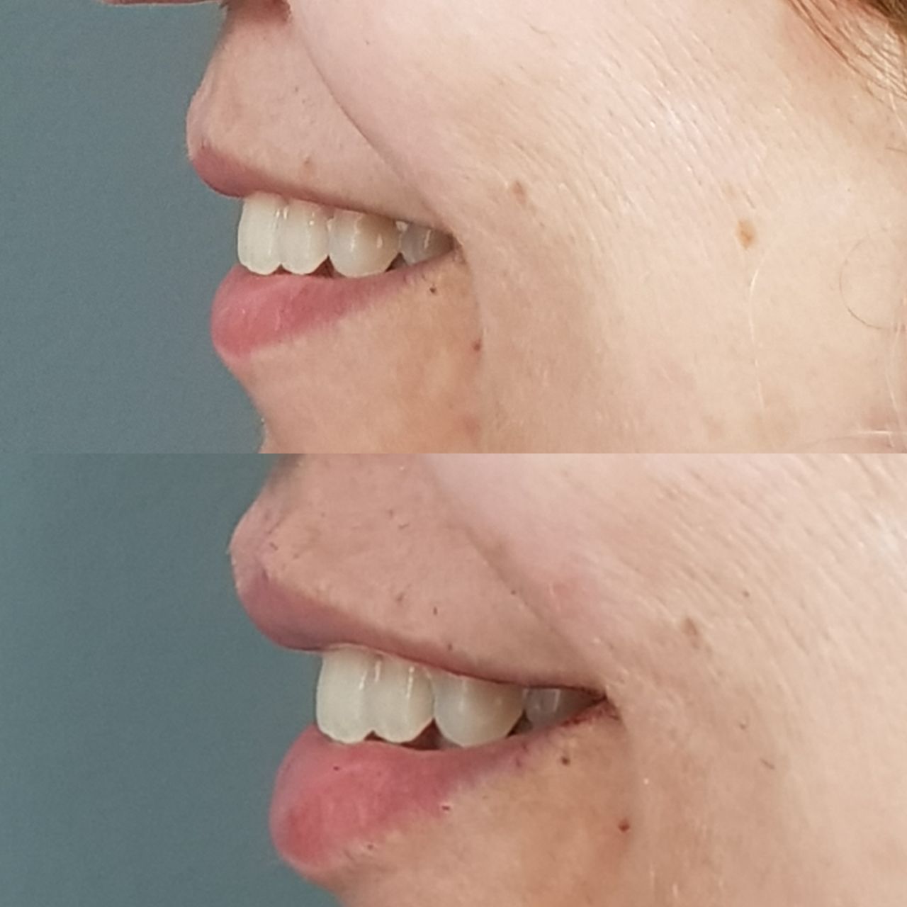 Rosalba Herrero Zerpa-228