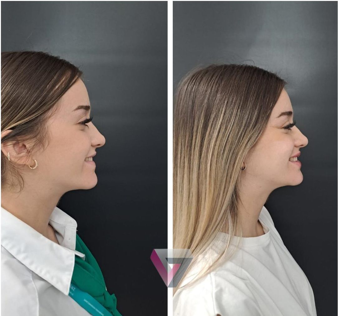 Victoria Trasmonte-45