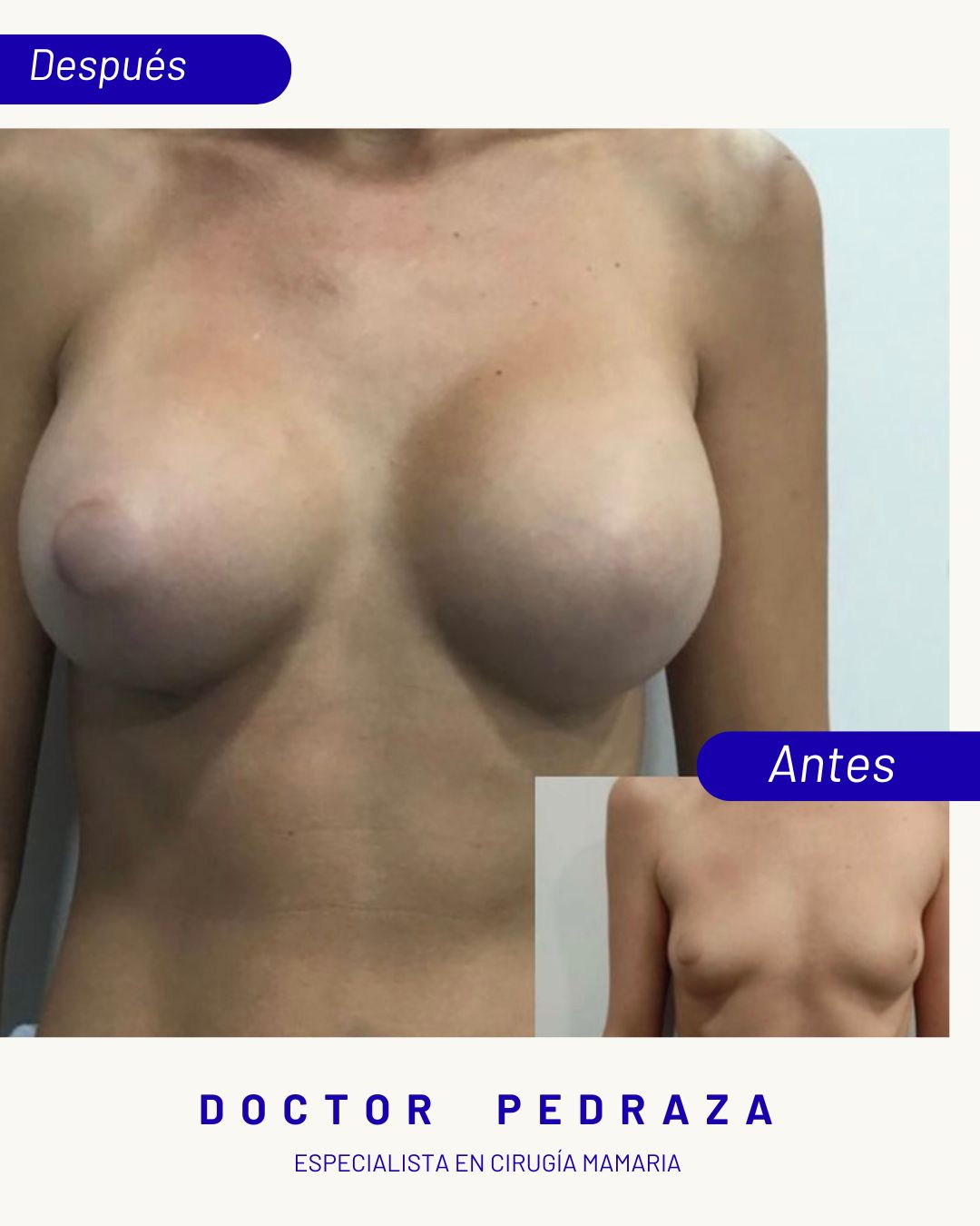 José María Pedraza Abad-0