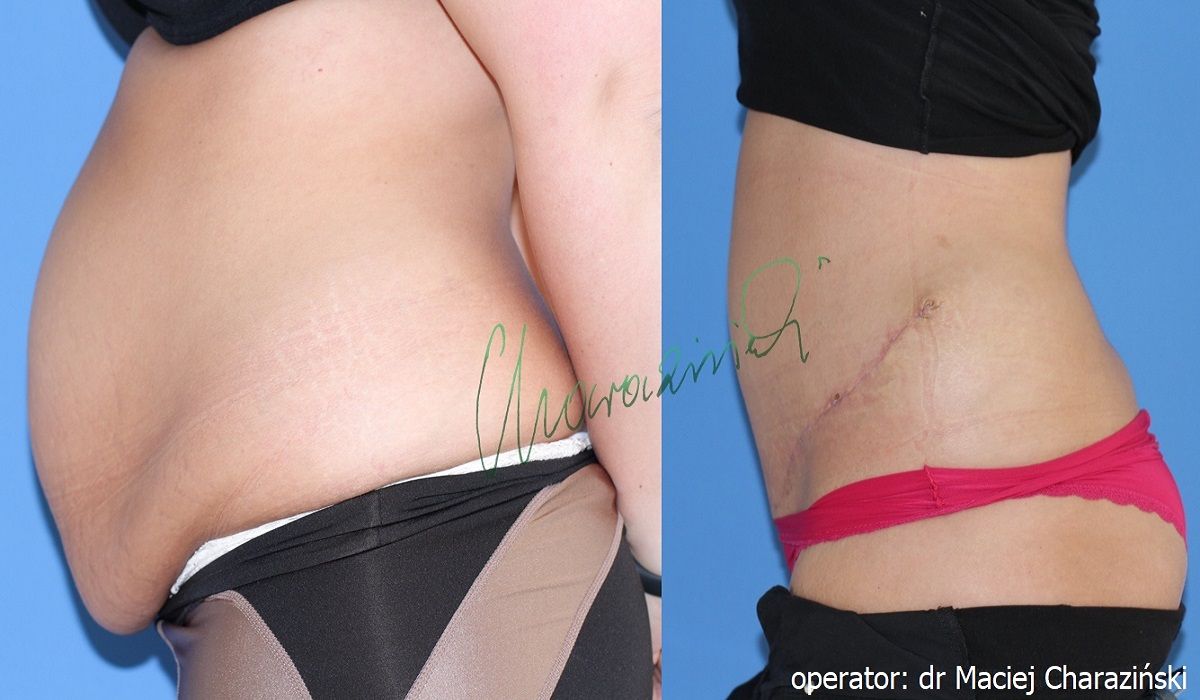 Maciej Charaziński-9