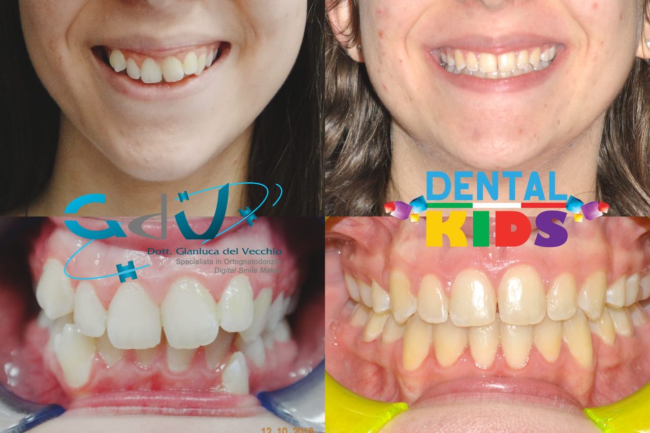 Gianluca Del Vecchio-172