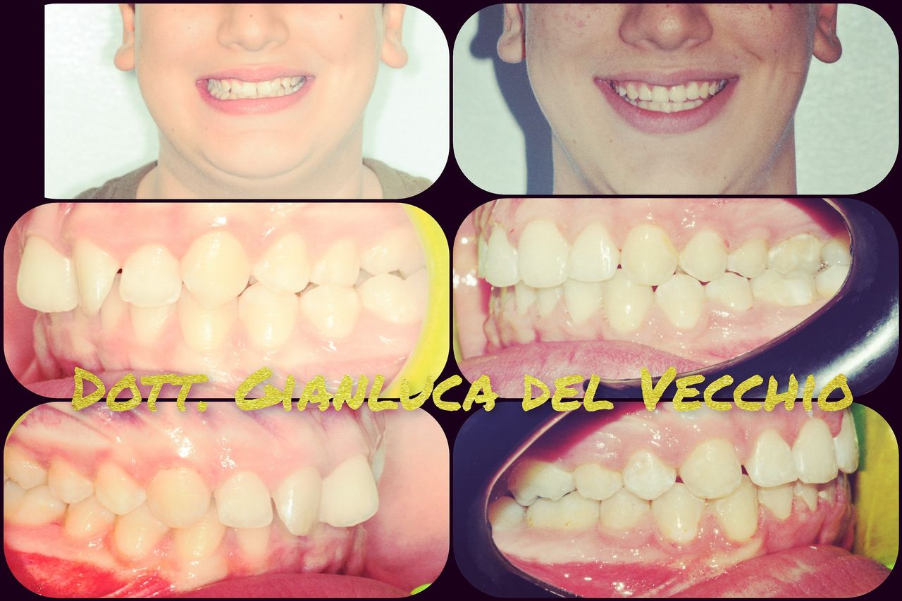 Gianluca Del Vecchio-117