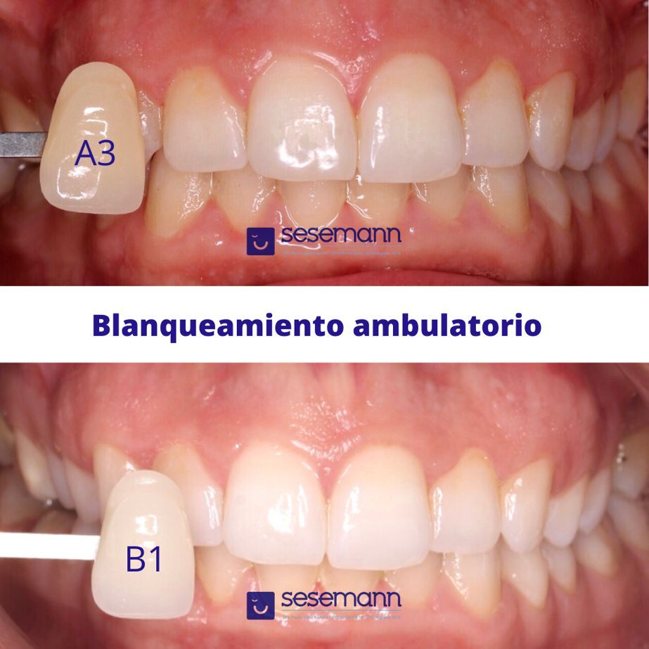 Paula Cano Carrillo-86