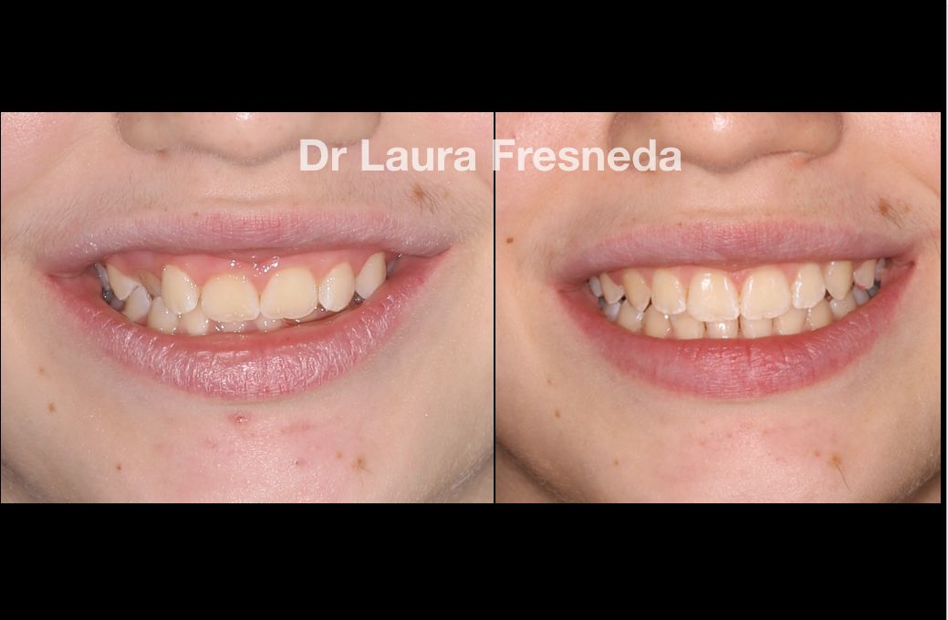 Laura Fresneda Bustos-9