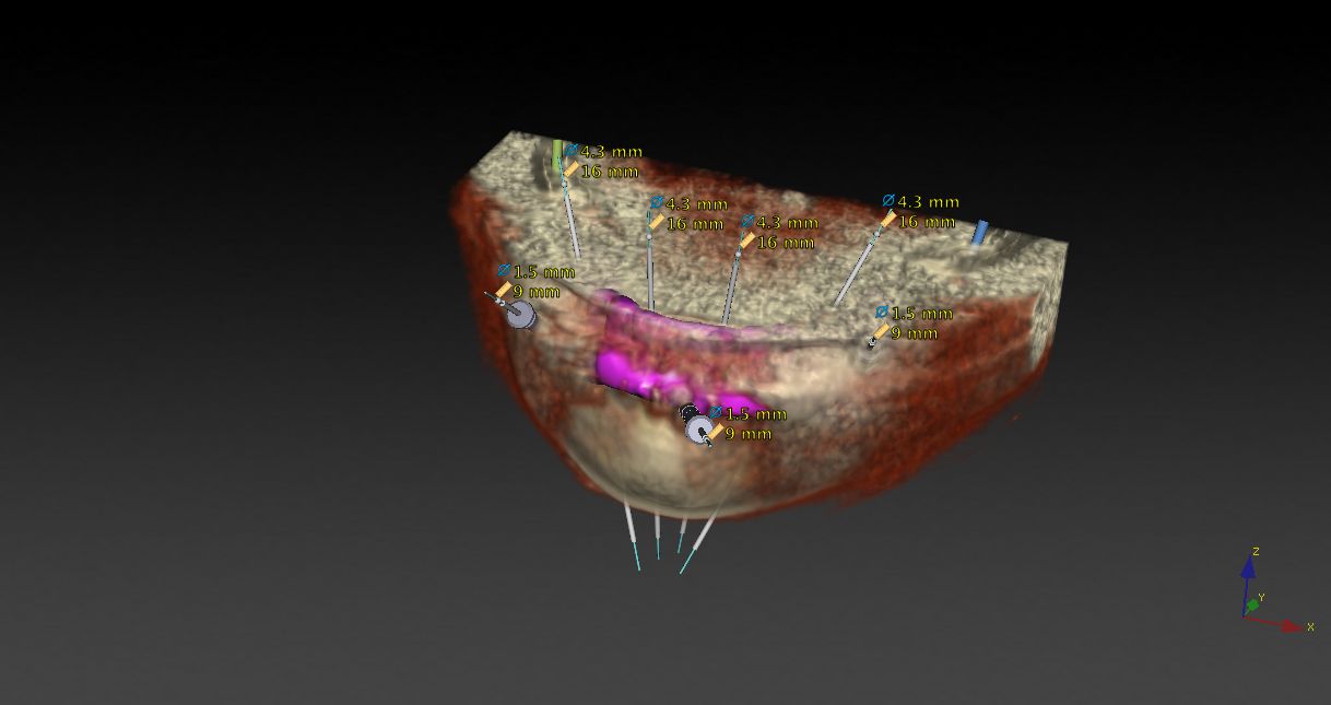 Alessandro Palumbo-18