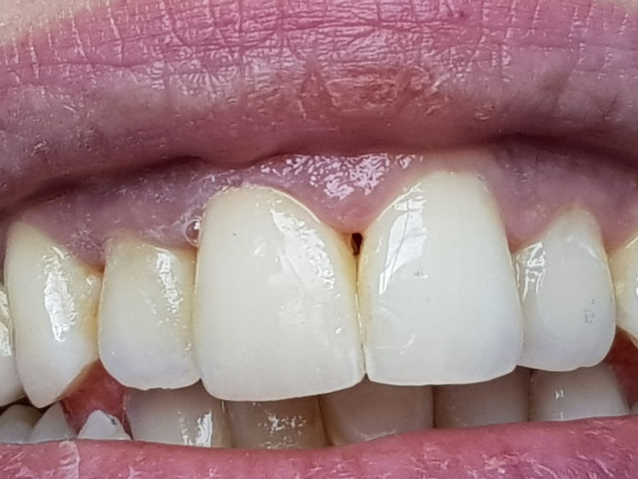 Stefano De Simone-69