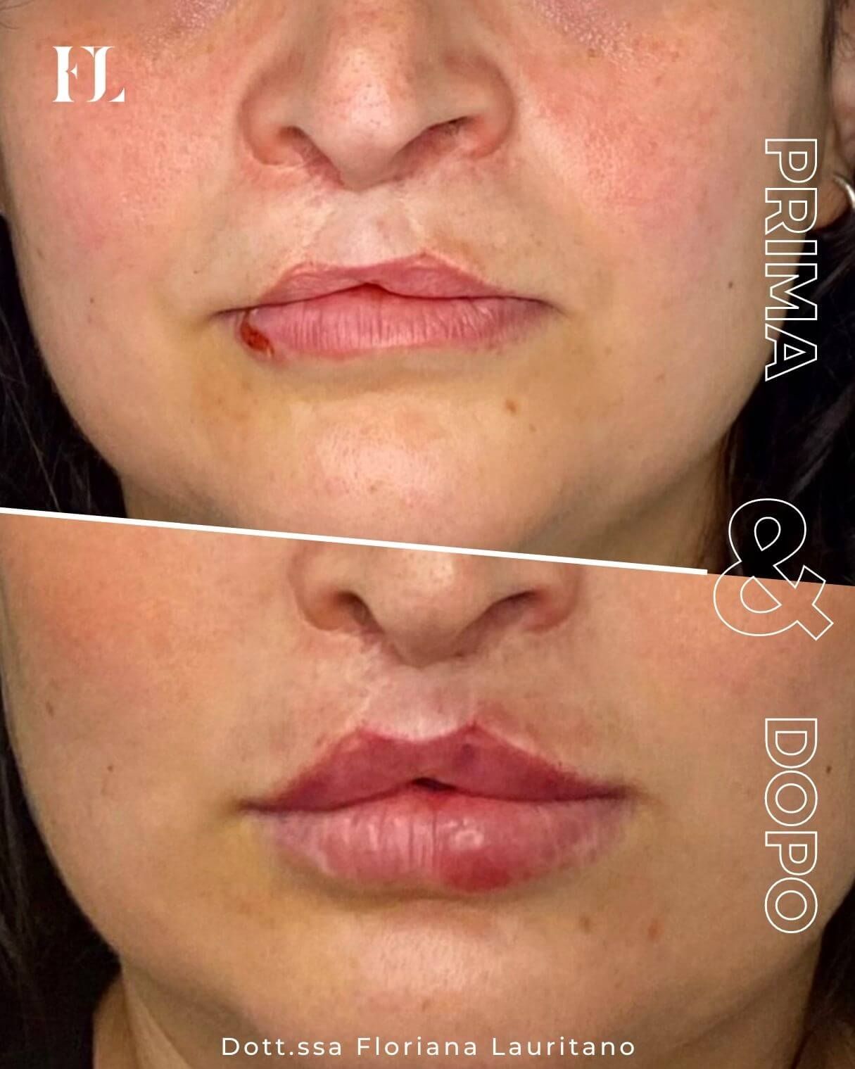 Floriana Lauritano-9