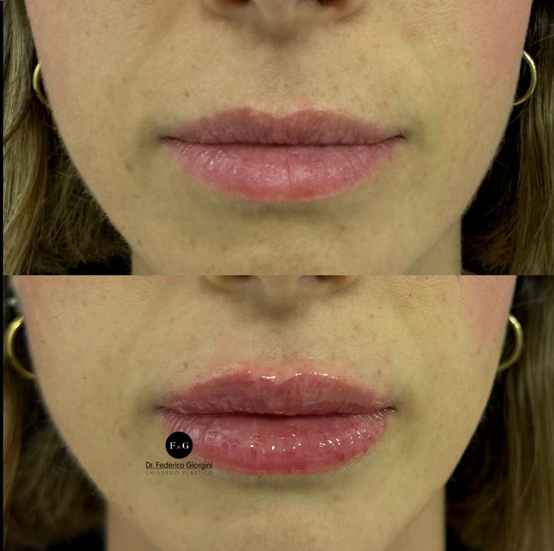 Federico Giorgini-18