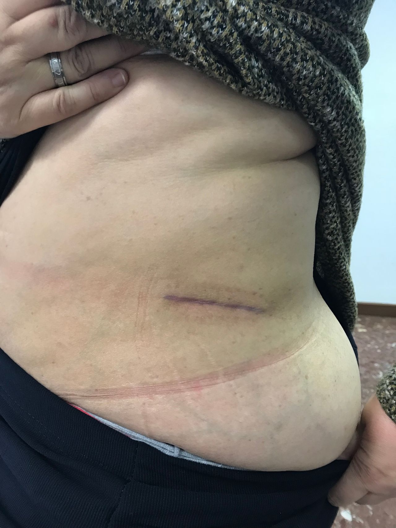 Juan Camilo Hernandez Acevedo-41