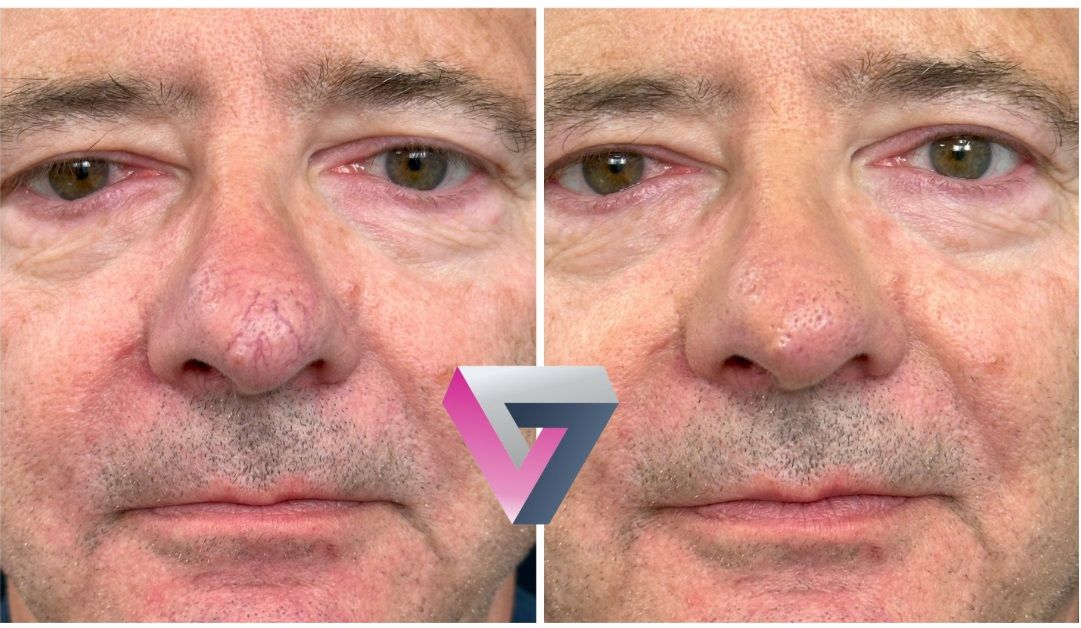 Victoria Trasmonte-99