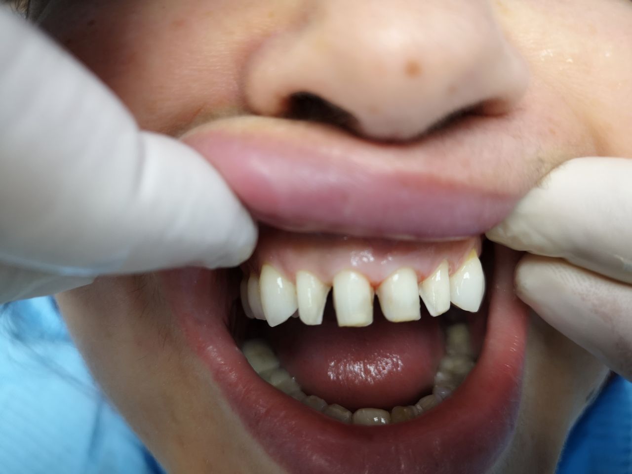 Stefano De Simone-75