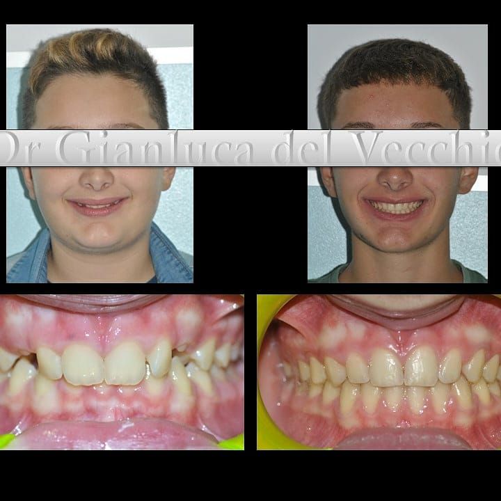 Gianluca Del Vecchio-52