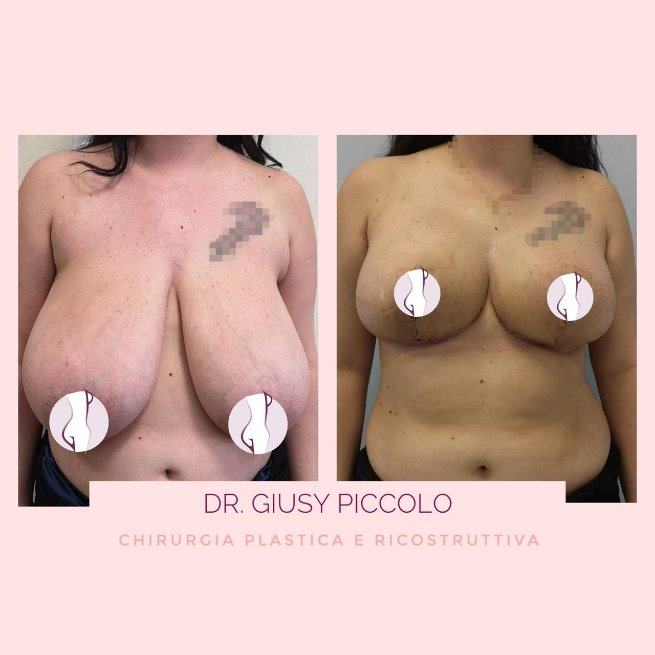 Giuseppina Piccolo-29