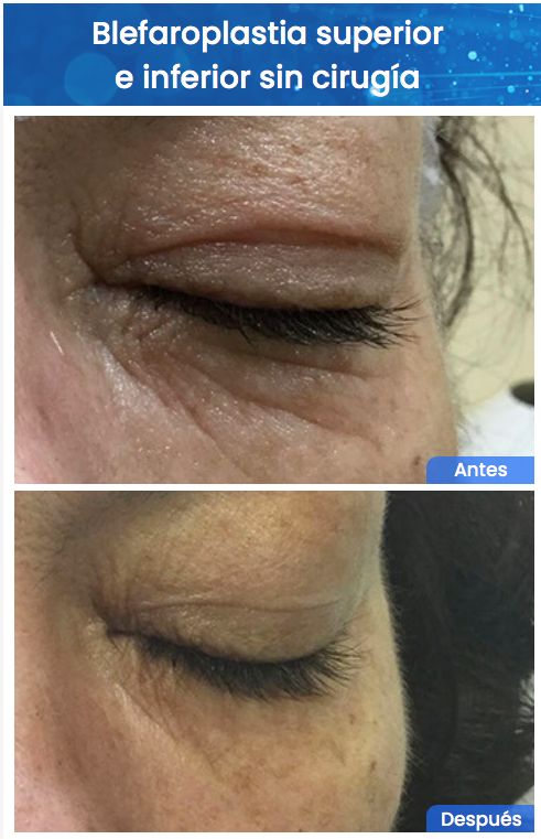 Juan Enrique Pérez Enríquez-139