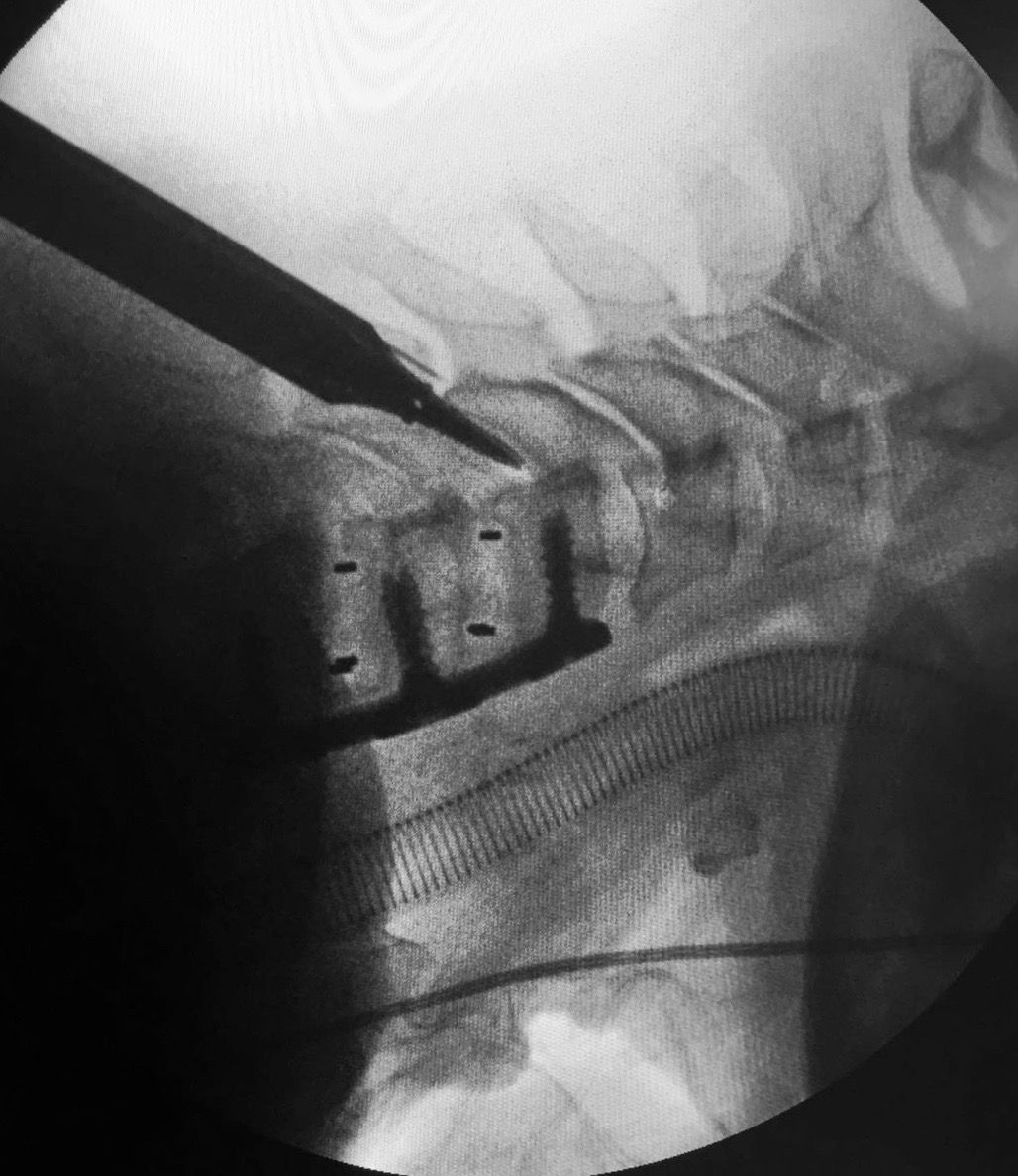 Juan Camilo Hernandez Acevedo-28