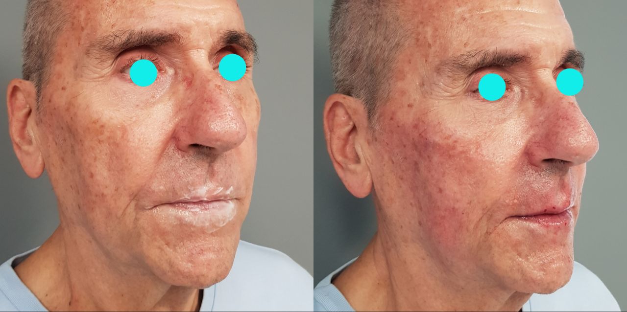 Rosalba Herrero Zerpa-470