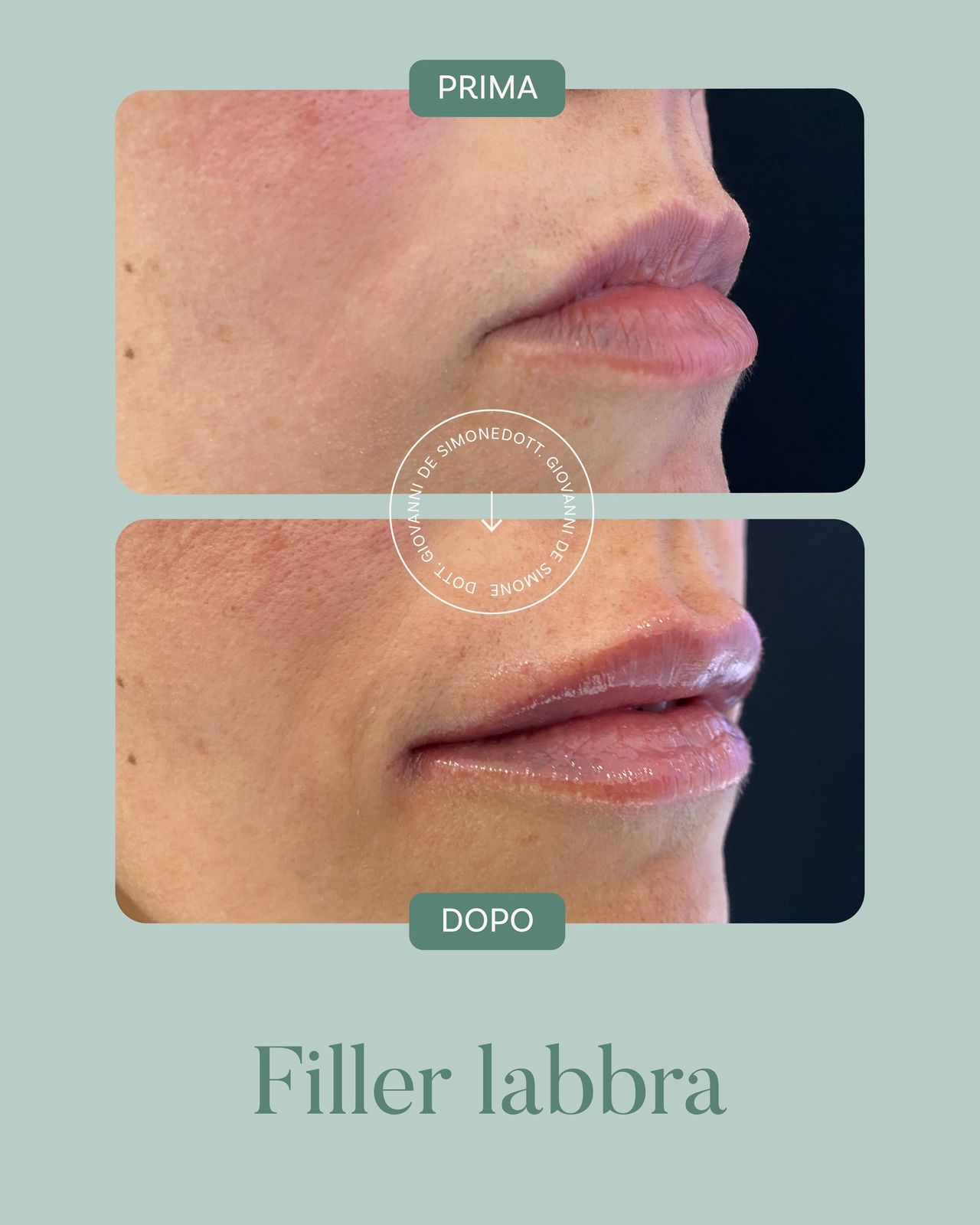 Giovanni De Simone-4