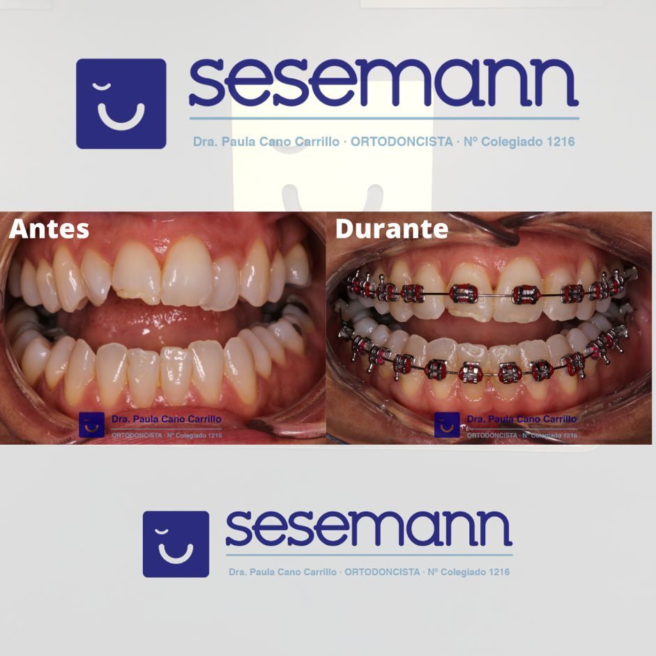 Paula Cano Carrillo-104