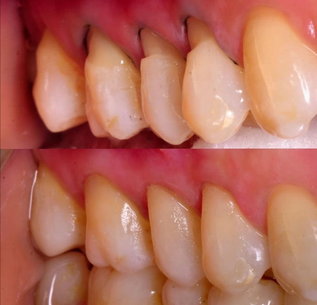 Alessandro Neglia-17