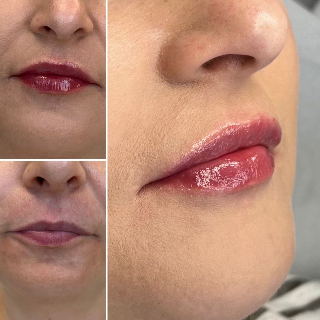 Dominika Kunysz-Schwermer-4