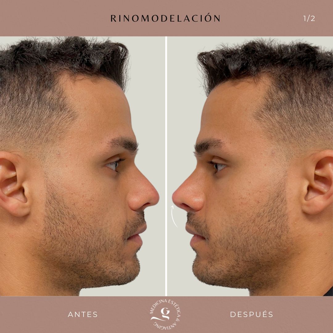 ​Giovanni Giorgianni-34