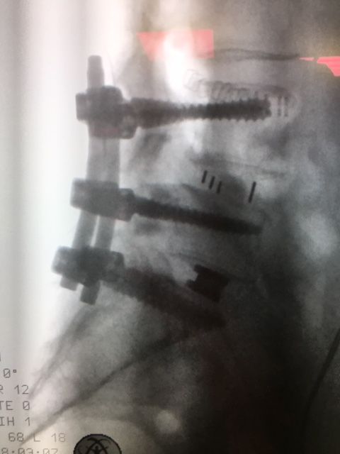 Massimo Brandolin-16