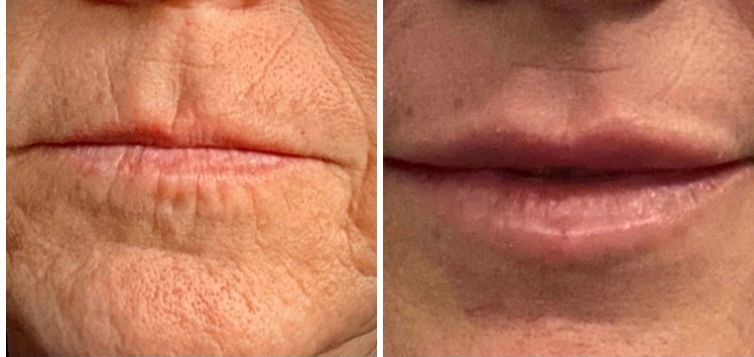 Silvia Melania Baio-10