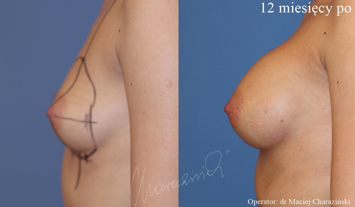 Maciej Charaziński-103