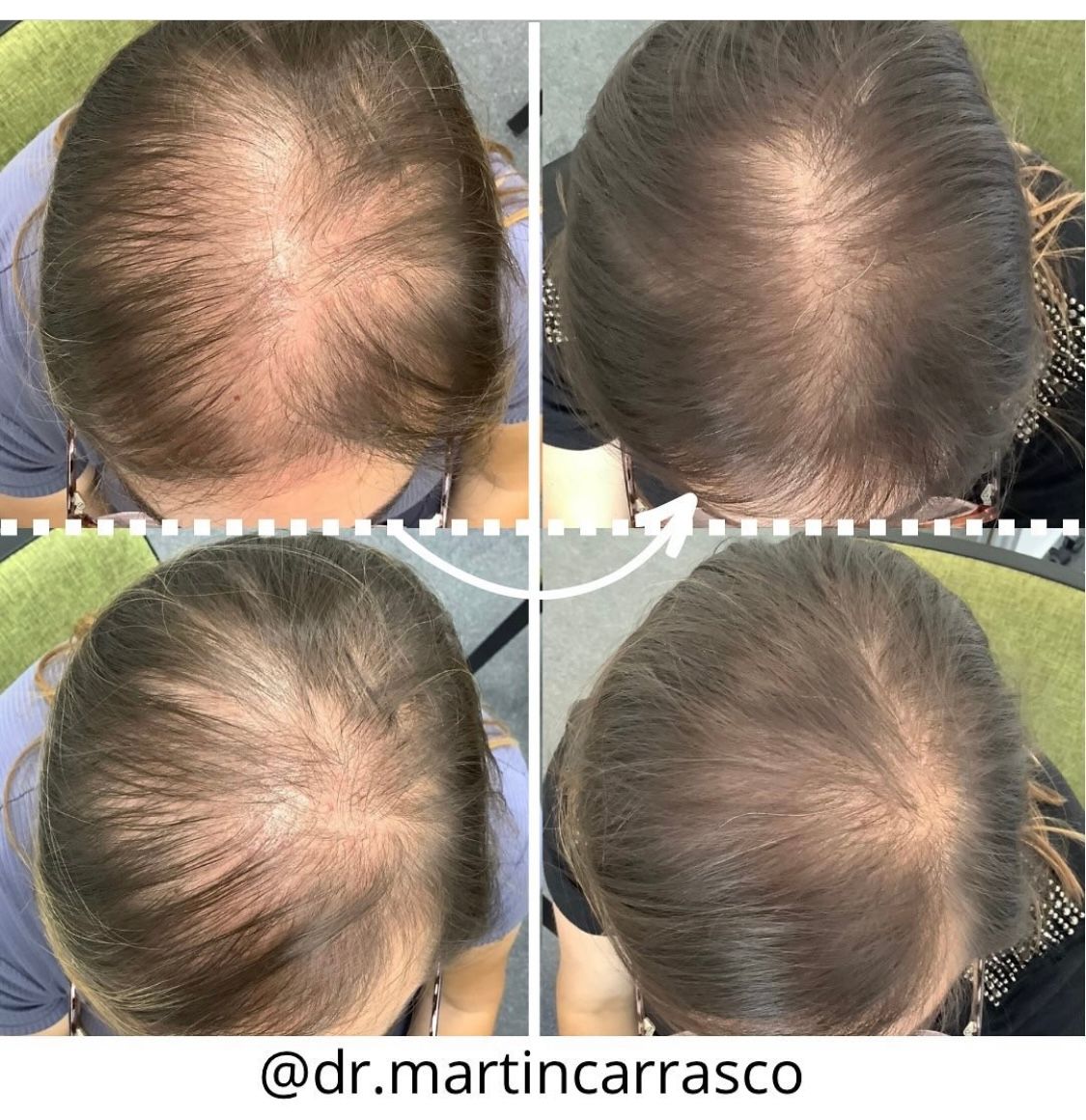 Pablo Martín Carrasco-18