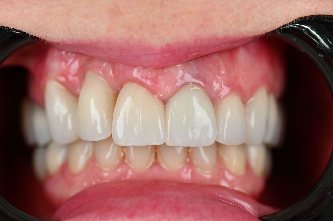 Magdalena Bińkowska-33