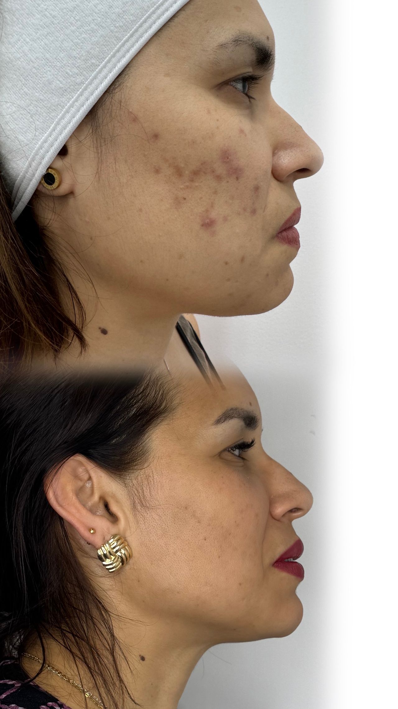 Yessica Corrales Acevedo-1