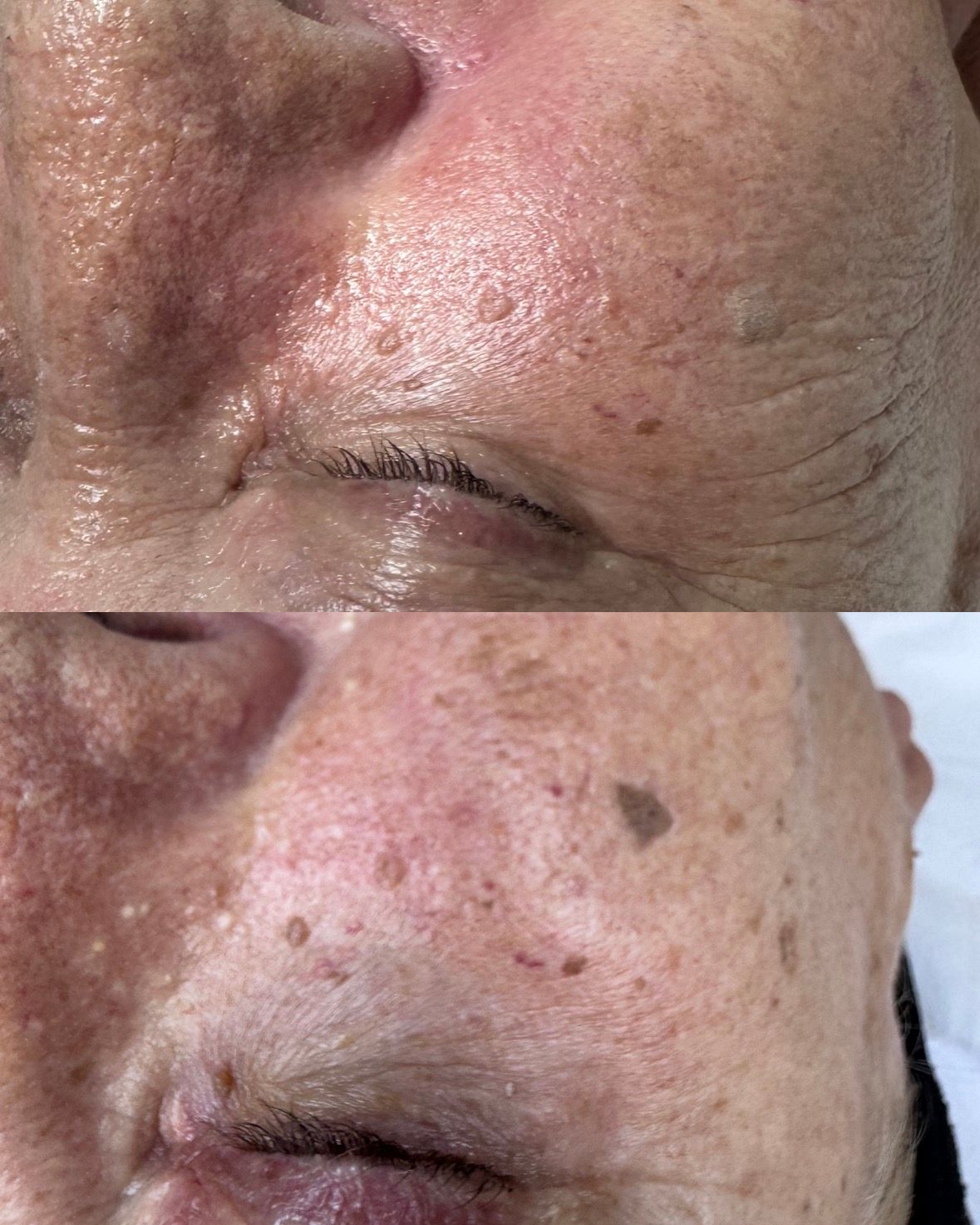 Yolimar Acevedo Raya-4