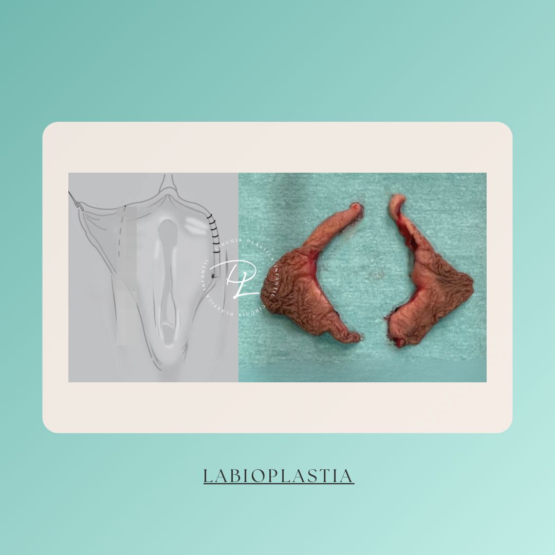 Concepción Lorca García-16