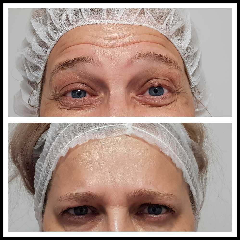 Rosalba Herrero Zerpa-295